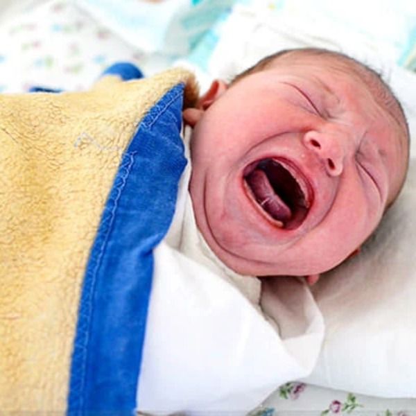 How-will-I-know-if-my-baby-has-a-tongue-tie_-My-Expert-Midwife Tongue Tie (Ikatan Lidah) & Penyusuan